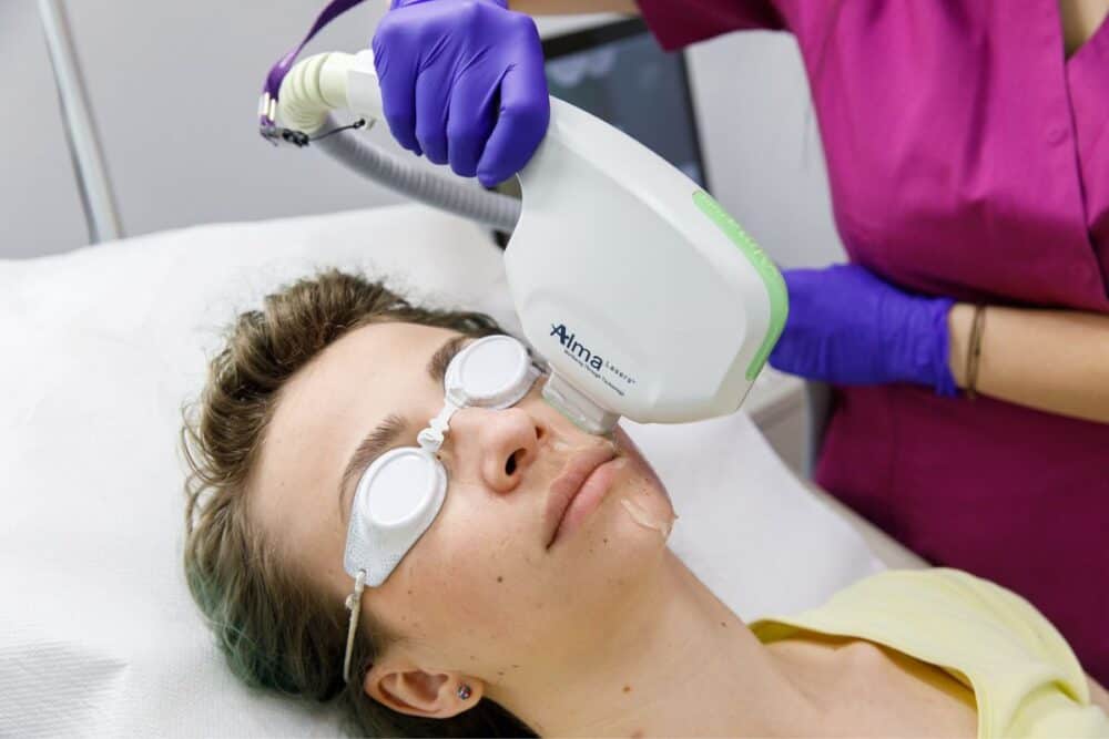 Terapii laser care tratează multe dintre afecţiunile dermatologice şi estetice vara