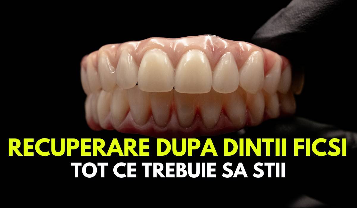 Recuperarea după procedura de dinți ficși pe implanturi dentare. Ce trebuie să știi